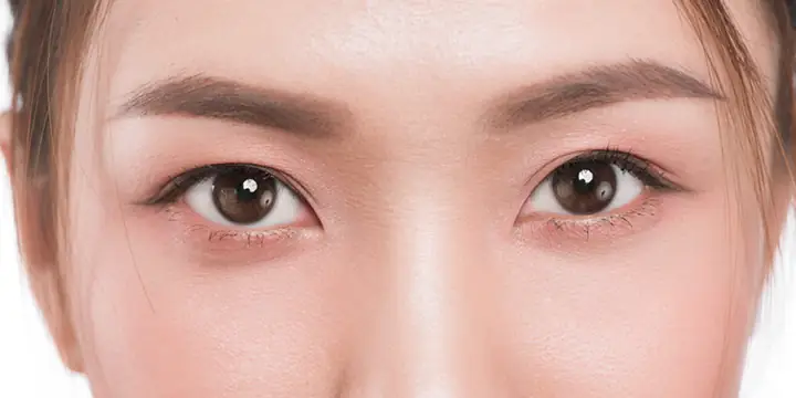 Tướng Mắt 2 Mí Tướng Mắt 2 Mí