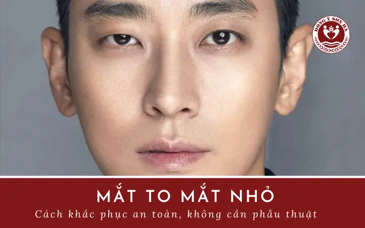 Tướng Mặt Bên To Bên Nhỏ