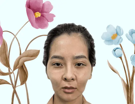 Tướng Mặt Bị Rỗ Tướng Mặt Bị Rỗ