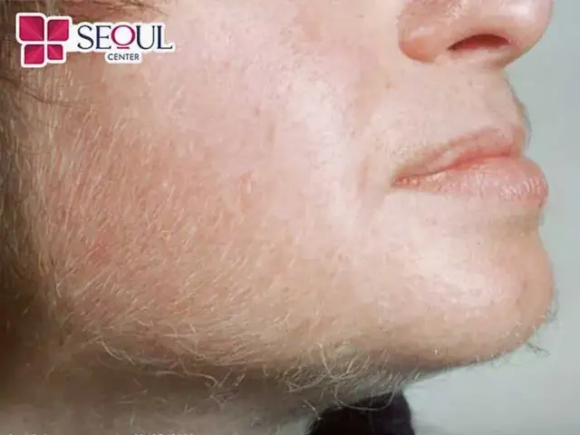 Tướng Mắt Có Son Đỏ Ở Lòng Trắng