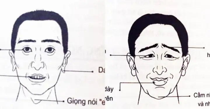 Tướng Mặt Đan Ông Lăng Nhăng