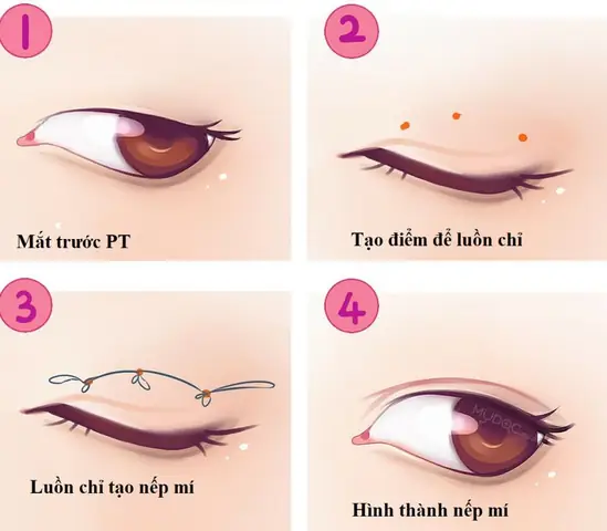 Tướng Mắt Hạnh Nhân