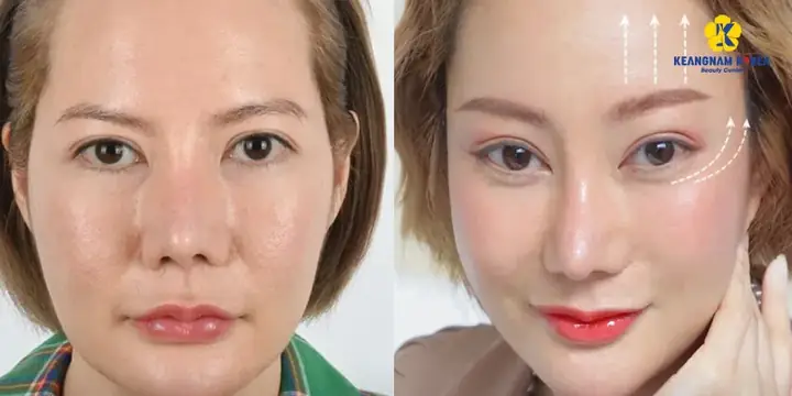 Tướng Mắt Khóe Mắt Hướng Xuống