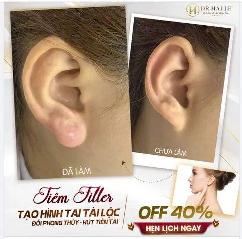 Tướng Mặt Làm Quan