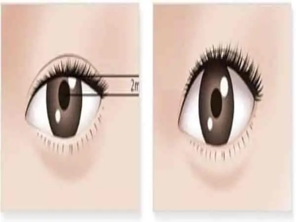 Tướng Mắt Lờ Đờ Tướng Mắt Lờ Đờ