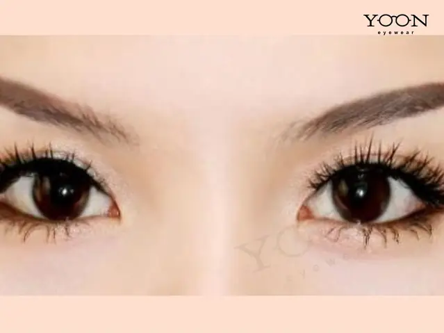 Tướng Mắt Lòng Đen Nhiều