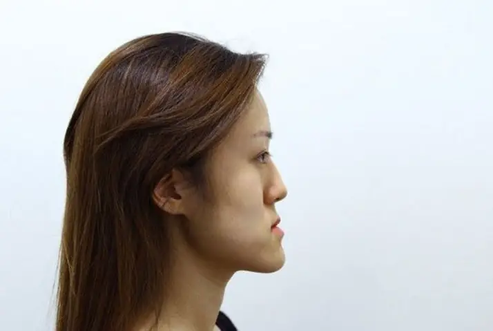 Tướng Mặt Lưỡi Cày Tướng Mặt Lưỡi Cày