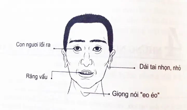Tướng Mặt Người Đàn Ông Trăng Hoa Tướng Mặt Người Đàn Ông Trăng Hoa