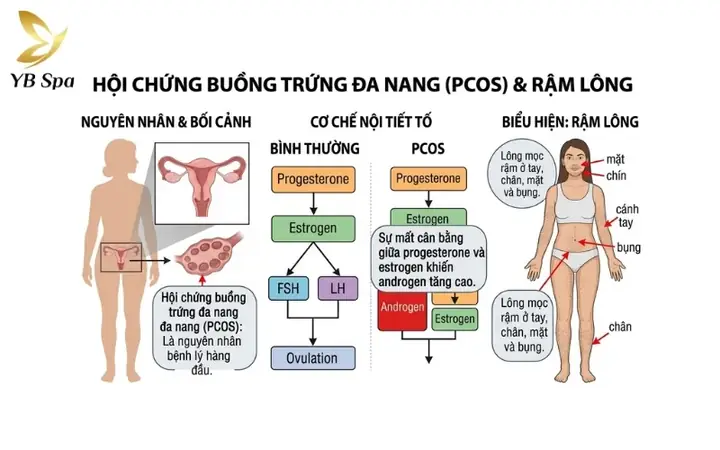 Tướng Mặt Nhiều Lông