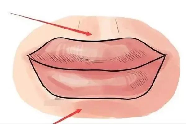 Tướng Miệng Cá Chép