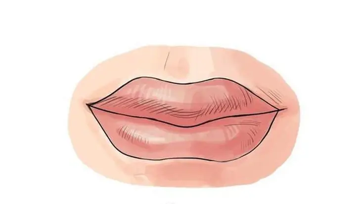 Tướng Miệng Chúm Chím