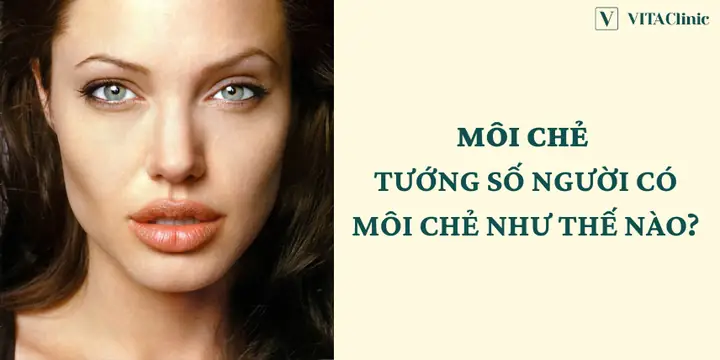 Tướng Miệng Có Hình