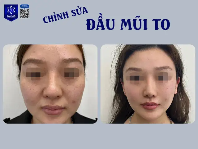 Tướng Miệng Đầy Dặn Vừa Phải Ở Phụ Nữ Tướng Miệng Đầy Dặn Vừa Phải Ở Phụ Nữ