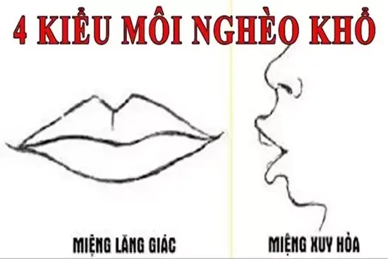 Tướng Miệng Lăng Giác