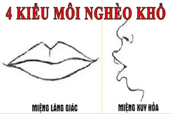 Tướng Miệng Lăng Giác