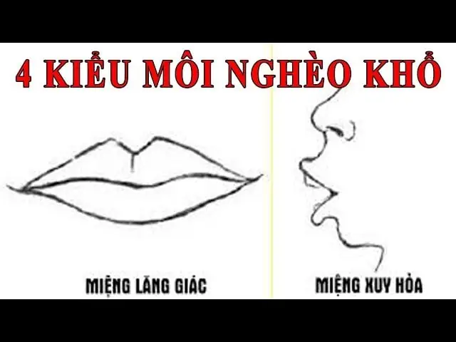 Tướng Miệng Lăng Giác