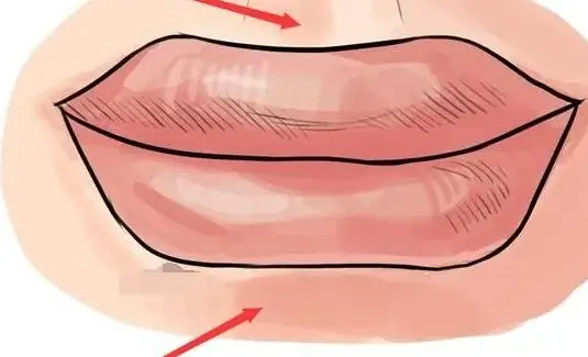 Tướng Miệng Phú Quý