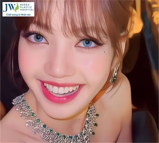 Tướng Miệng Rộng Môi Dày