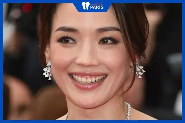 Tướng Miệng Rộng Môi Dày