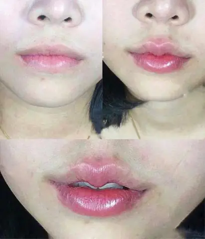 Tướng Môi Chúm Chím Tướng Môi Chúm Chím