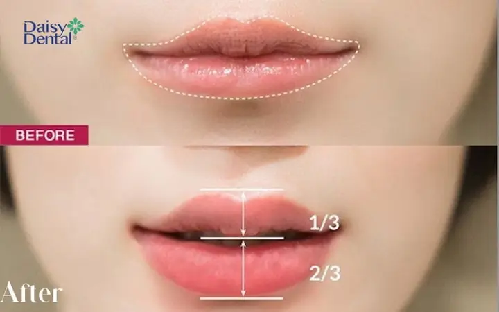 Tướng Môi Cười Cánh Cung