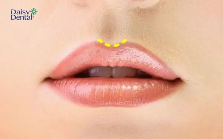 Tướng Môi Cười Cánh Cung