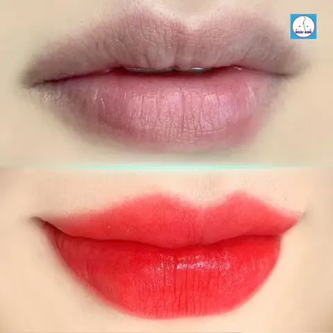 Tướng Môi Hồng Tự Nhiên