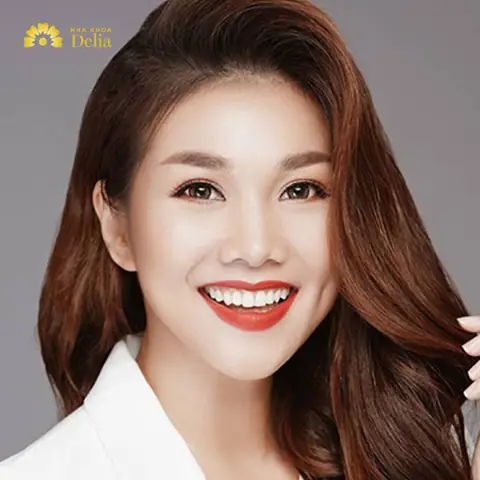 Tướng Môi Phú Quý
