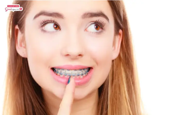 Tướng Môi Trề Răng Khê Nh