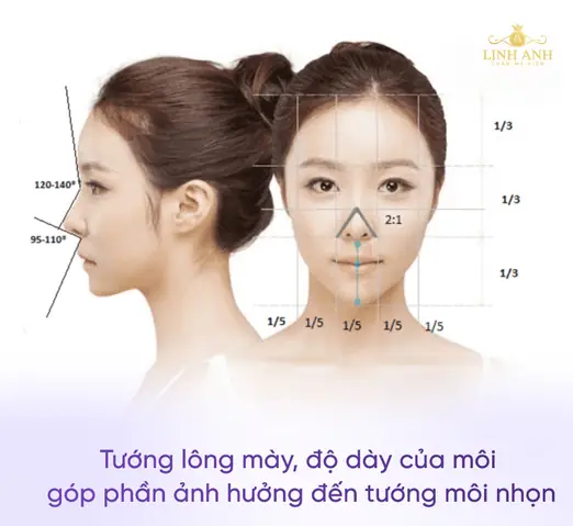 Tướng Môi Trên Nhô Ra