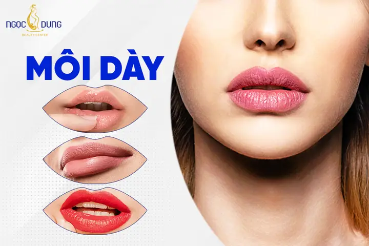 Tướng Môi Trên Thâm Môi Dưới Đỏ