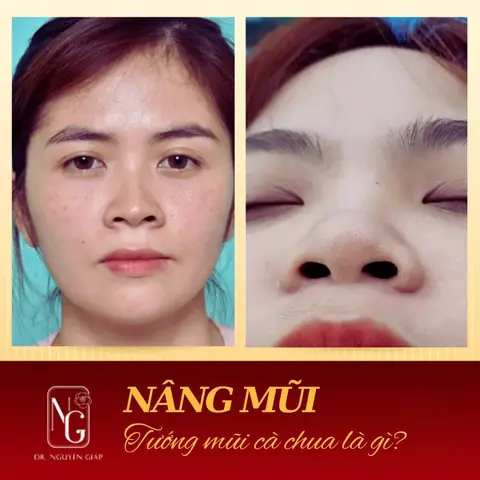 Tướng Mũi Cả Chua Tướng Mũi Cả Chua