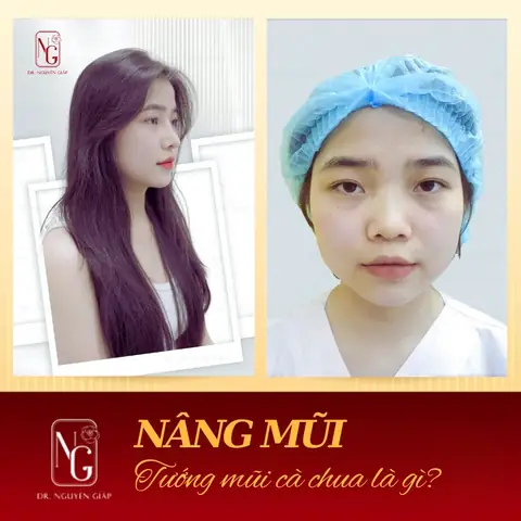 Tướng Mũi Cả Chua Tướng Mũi Cả Chua