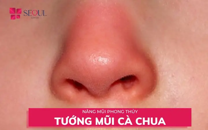 Tướng Mũi Cả Chua Tướng Mũi Cả Chua