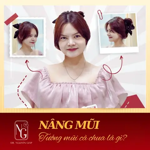 Tướng Mũi Cà Chua Tướng Mũi Cà Chua