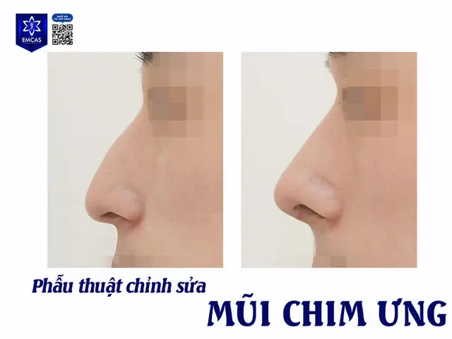 Tướng Mũi Chim Ưng Tướng Mũi Chim Ưng