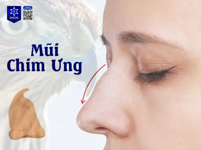 Tướng Mũi Chim Ưng