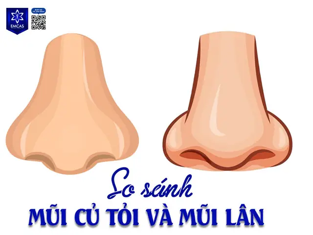 Tướng Mũi Củ Tỏi Tướng Mũi Củ Tỏi