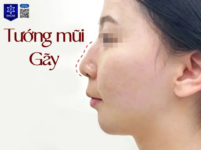 Tướng Mũi Đàn Bà Giàu Sang