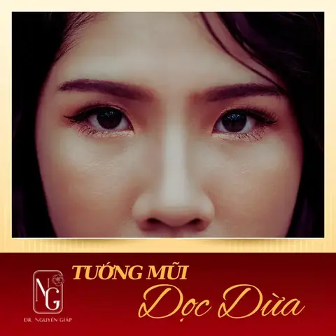 Tướng Mũi Dọc Dừa