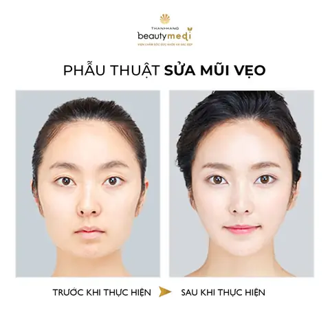 Tướng Mũi Giàu Sang Của Phụ Nữ Tướng Mũi Giàu Sang Của Phụ Nữ