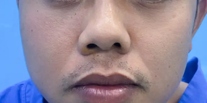 Tướng Mũi Hếch Đàn Ông