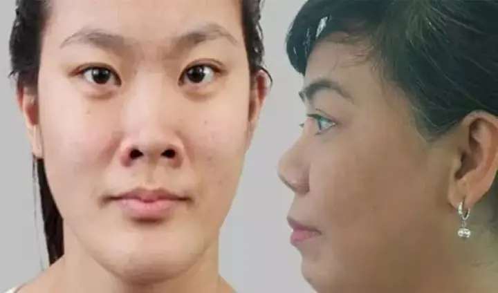 Tướng Mũi Hếch Phụ Nữ Tướng Mũi Hếch Phụ Nữ