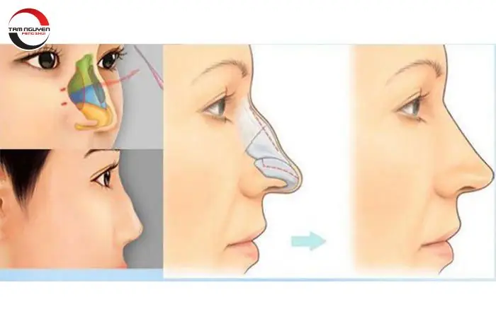 Tướng Mũi Lưỡi Dao Tướng Mũi Lưỡi Dao