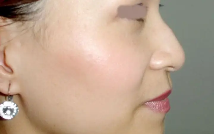 Tướng Mũi Nhìn Mồm