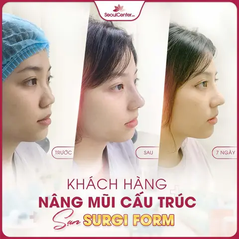 Tướng Mũi Nhìn Mồm Tướng Mũi Nhìn Mồm