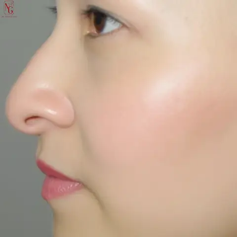 Tướng Mũi Nhòm Mồm