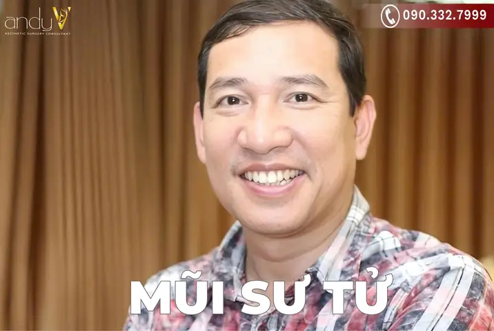 Tướng Mũi Sư Tử Là Gì