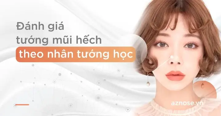Tướng Mũi Tẹt Hếch