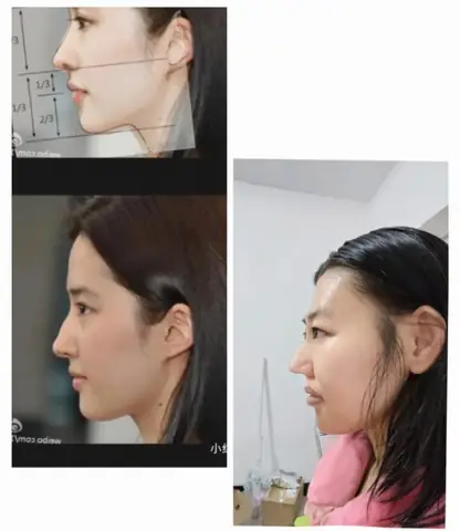 Tướng Mũi Tiểu Long Tướng Mũi Tiểu Long